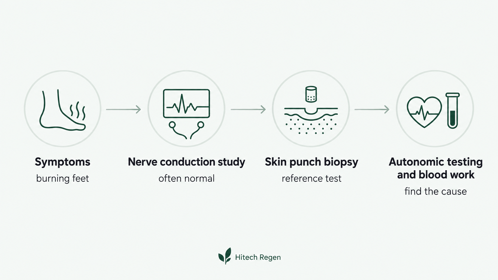 Infographic showing the small fiber neuropathy diagnostic pathway from symptoms to skin punch biopsy, autonomic testing and blood work